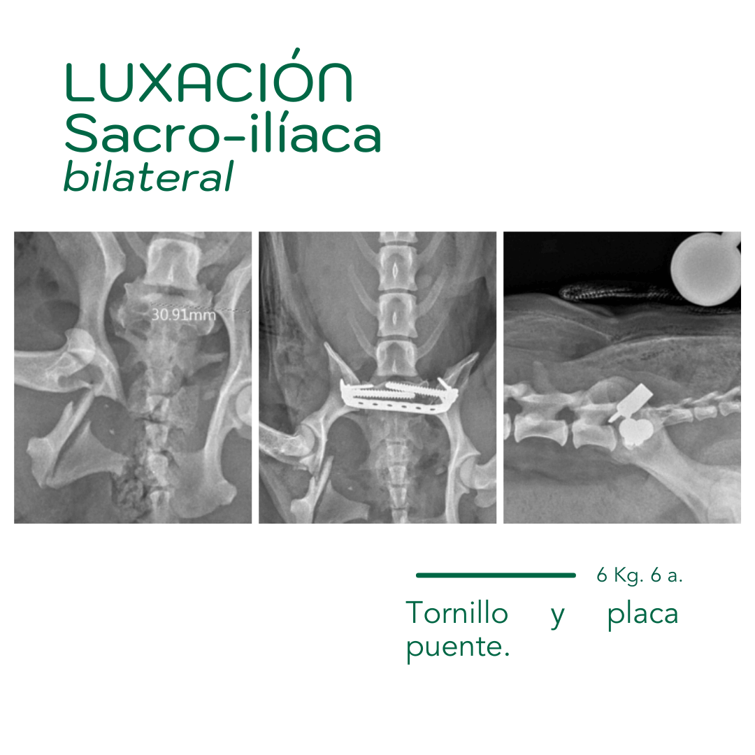 Traumatologia caso práctico Hospital Menescal