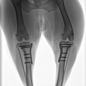 Caso TPLO Tibia 2 caso-tplo-3