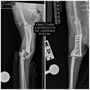 Caso TPLO Tibia 4 casos remitidos fractura