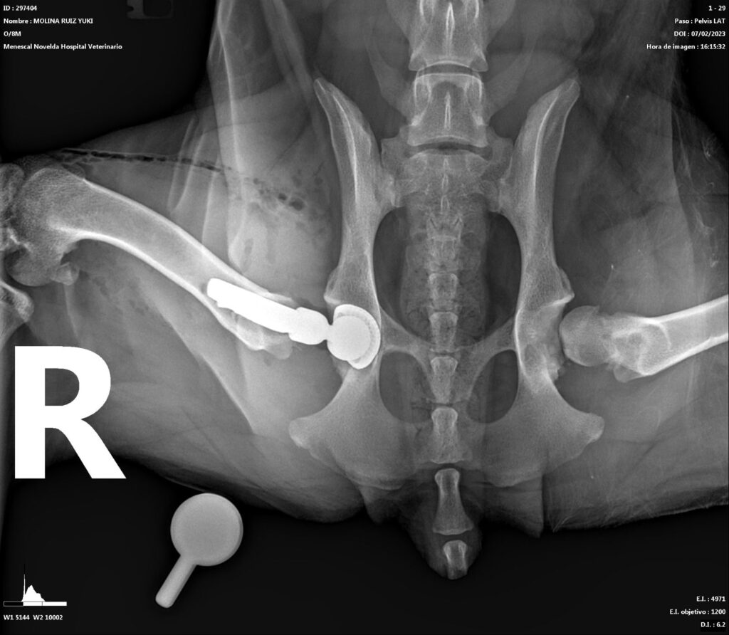 RX displasia de cadera 